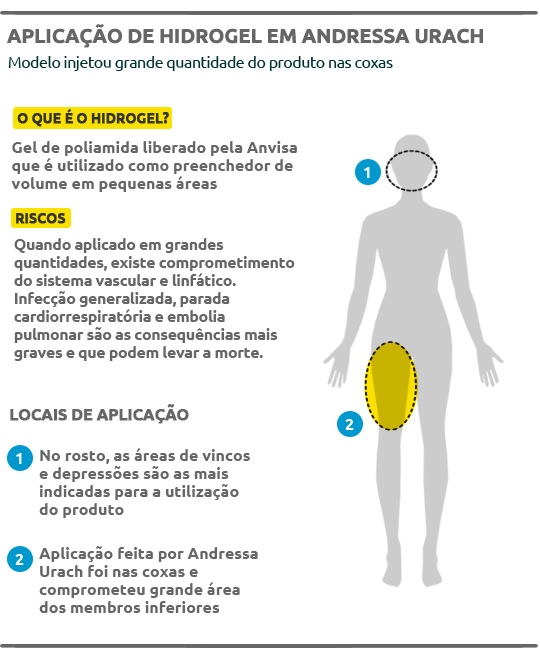 “Ken humano”, Celso Santabañes é internado devido ao uso de hidrogel