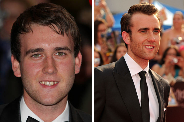 Ator da saga ‘Harry Potter’ aparece sarado em foto postada nas redes sociais; veja a transformação