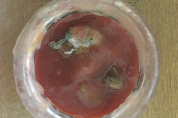 Bebê de 5 meses de idade é internada com intoxicação alimentar após comer papinha industrializada