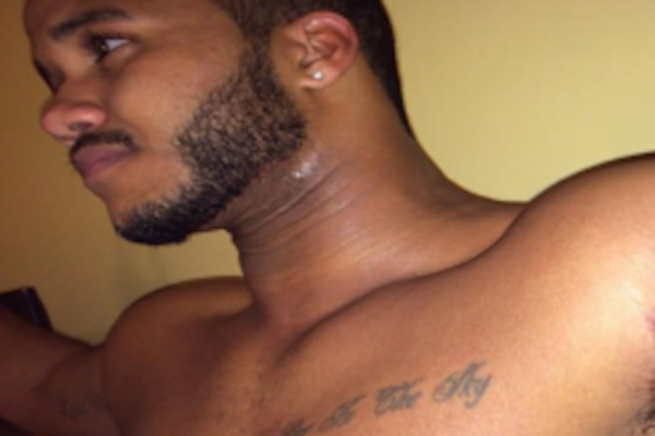 Usuários acusam famosa marca de desodorante de provocar graves queimaduras químicas