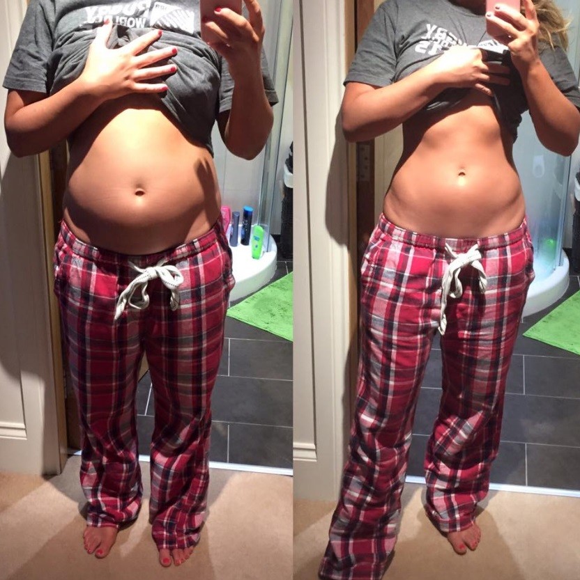 Blogueira surpreende seguidores com ‘antes e depois’ de sua barriga em apenas 12 horas