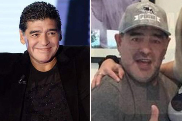 Diego Maradona faz plástica e aparece muito diferente em nova foto