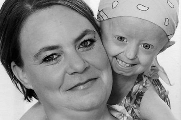 Garota com doença rara que causa velhice precoce morre aos 17 anos