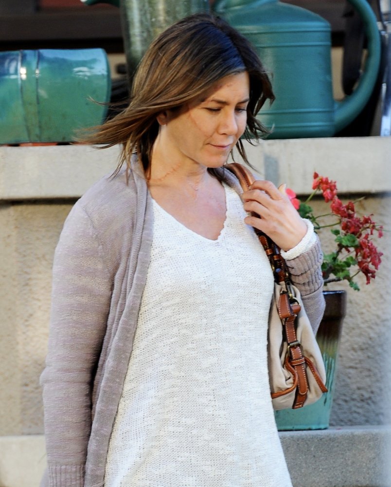 Jennifer Aniston surpreende com cicatrizes no rosto em novo filme