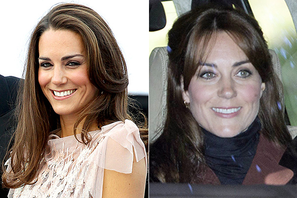 kate-antes-e-depois