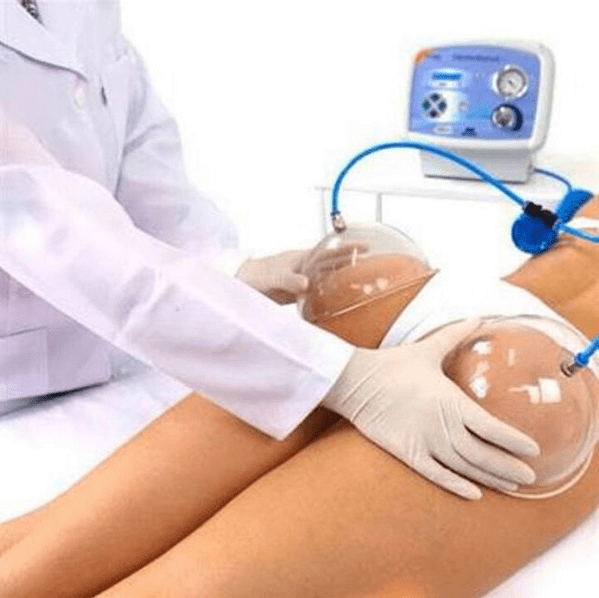 Polêmica, técnica de ‘sugar o bumbum com ventosas’ não promove efeito a longo prazo