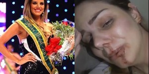 Miss grava vídeo e denuncia agressão de ex-marido