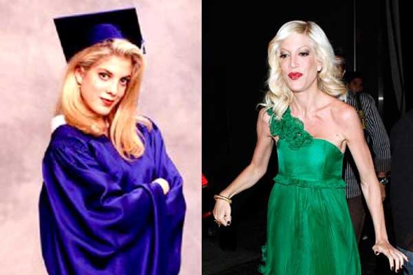 Tori Spelling, de “Barrados no Baile”, é internada com suspeita de Ebola