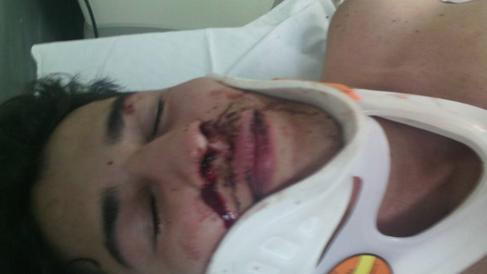 Gerente de boate LGBT é espancado ao pedir ajuda após assalto