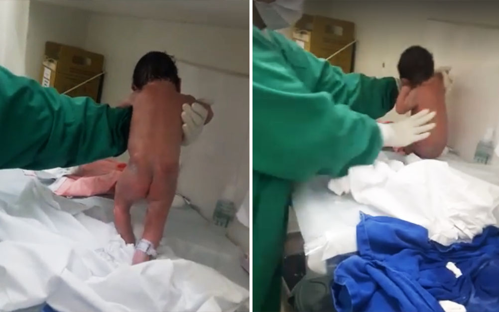 Por que este recém-nascido parece “caminhar” na maternidade?