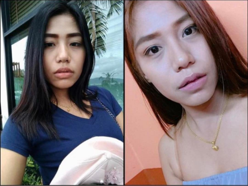 Redução labial é a nova tendência de beleza na Ásia