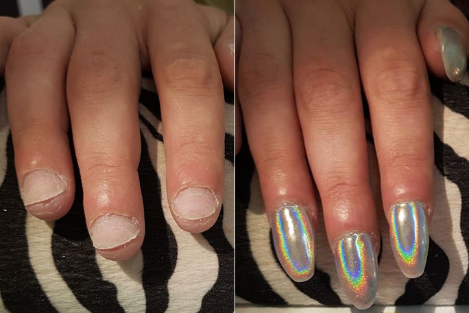 Alongamento mal feito deixa unhas de cliente deformadas