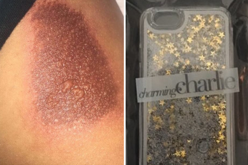 capinha-celular-glitter-perigo-04