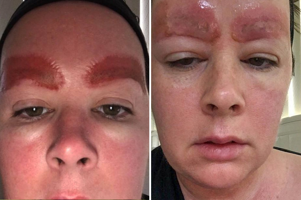 mae-procedimento-estetico-03