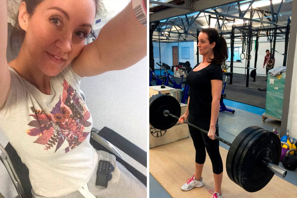 mulher-derrame-medular-04