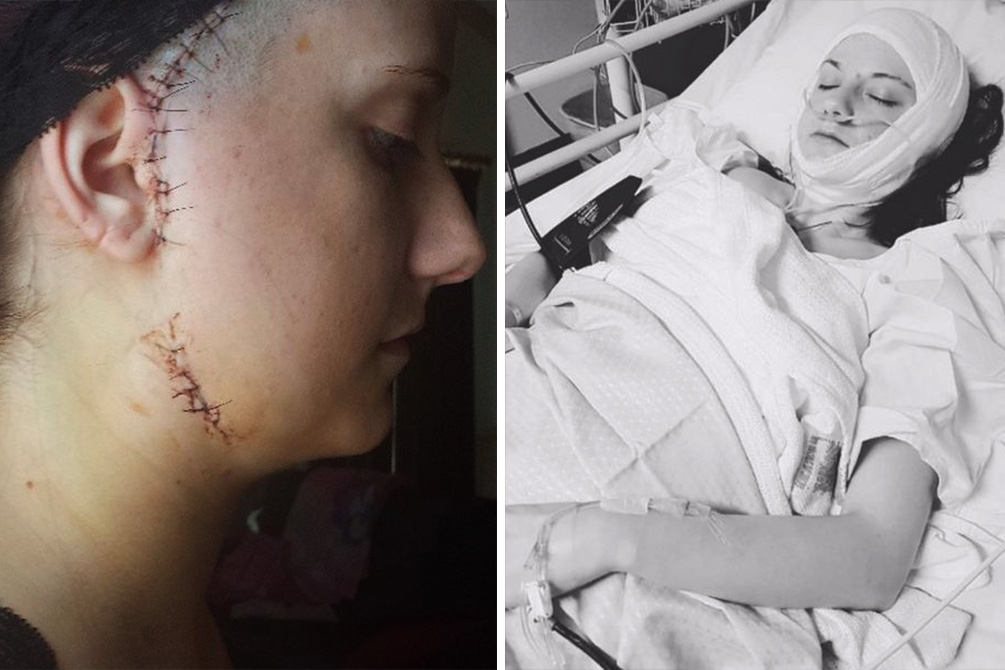 mulher-ignora-sintoma-cirurgia-03