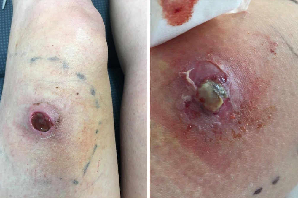 mae-picada-aranha-04