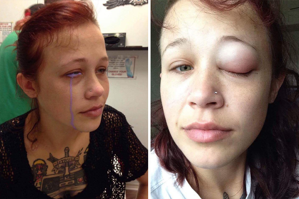 tatuagem-cegueira-01