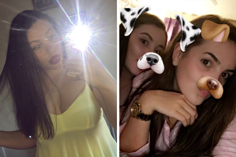 Jovem se arrepende de fazer bronzeamento antes de ir à academia