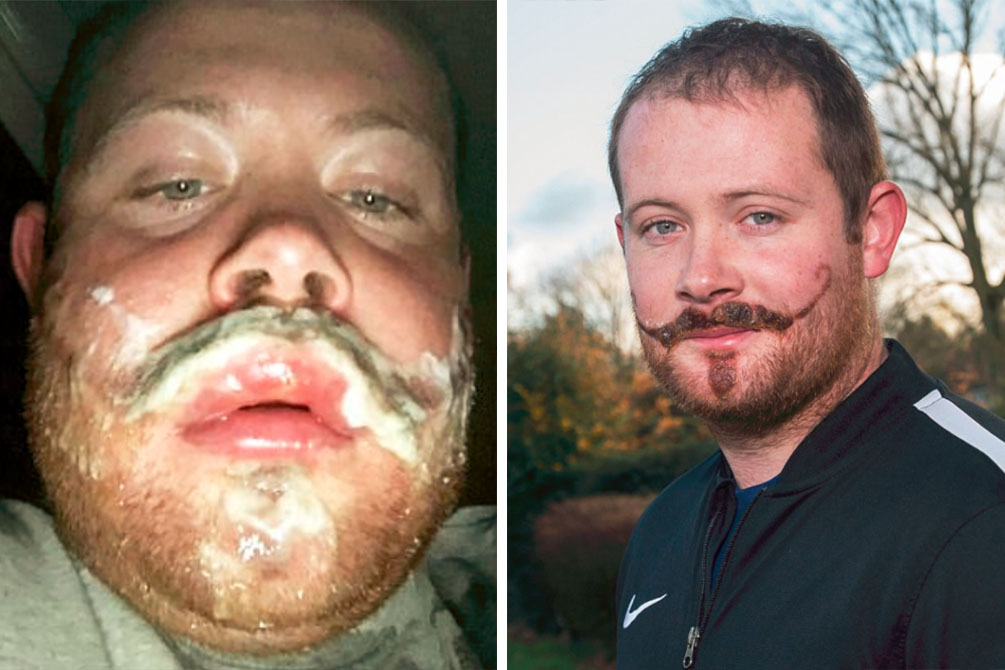 tatuagem-henna-cicatriz-bigode-03