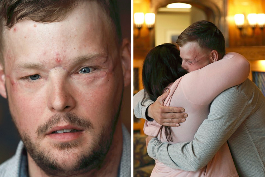 viuva-reencontro-marido-transplante (4)