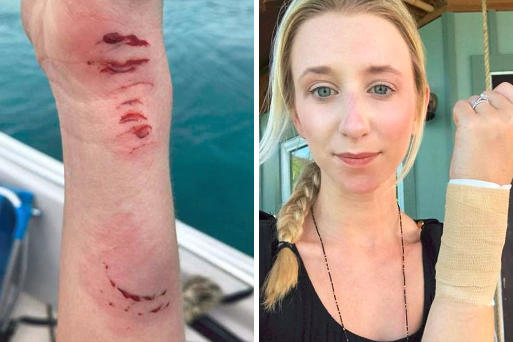 ataque-tubarao-lua-de-mel-01