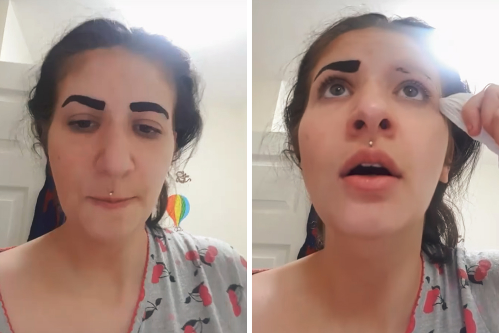 Jovem perde sobrancelhas ao usar cosmético comprado na web