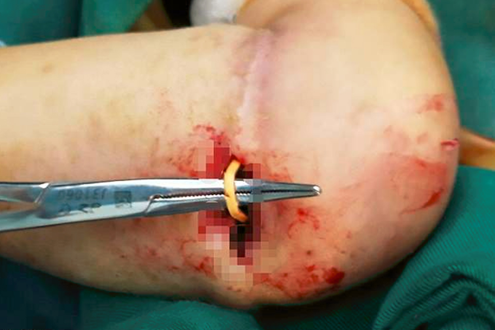 alerta-objeto-inesperado-crianca-04