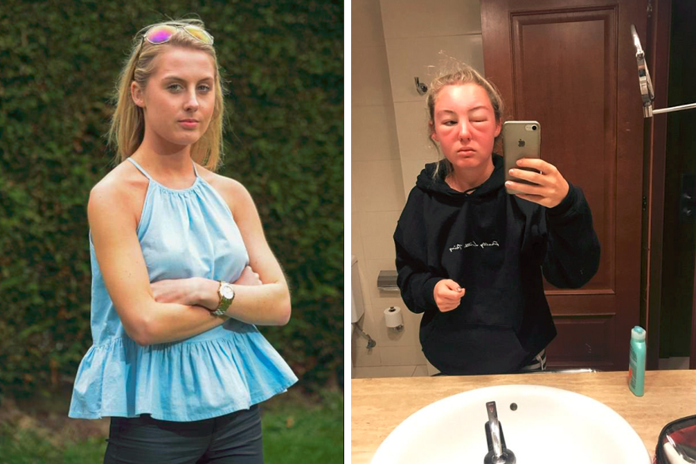 Jovem desabafa após susto durante viagem a ilha na Espanha