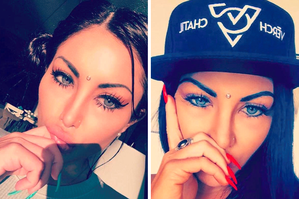 Jovem perde 80% da visão após procedimento controverso