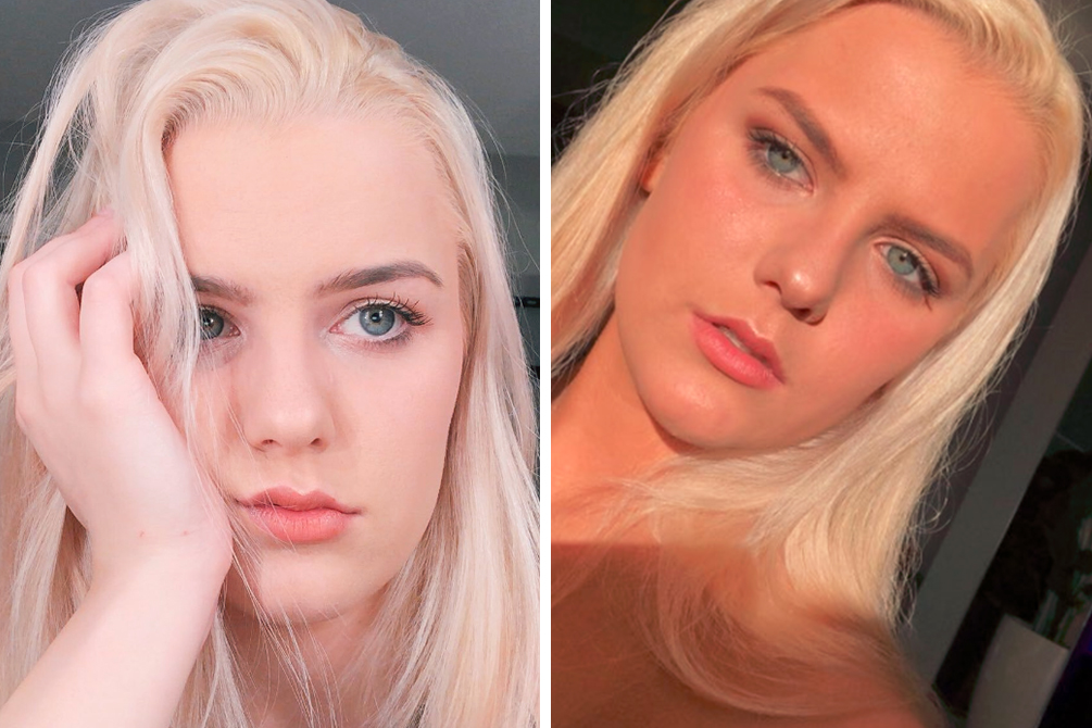 Jovem revela por que se arrependeu de chorar após bronzeamento artificial