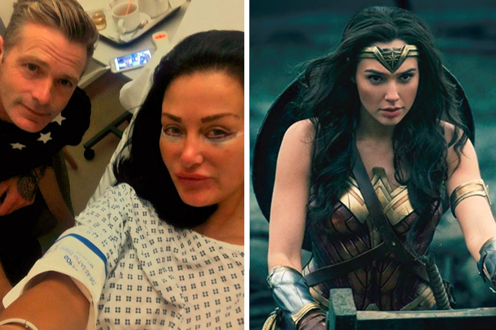 Mulher investe 490 000 reais para ficar parecida com a Mulher-Maravilha