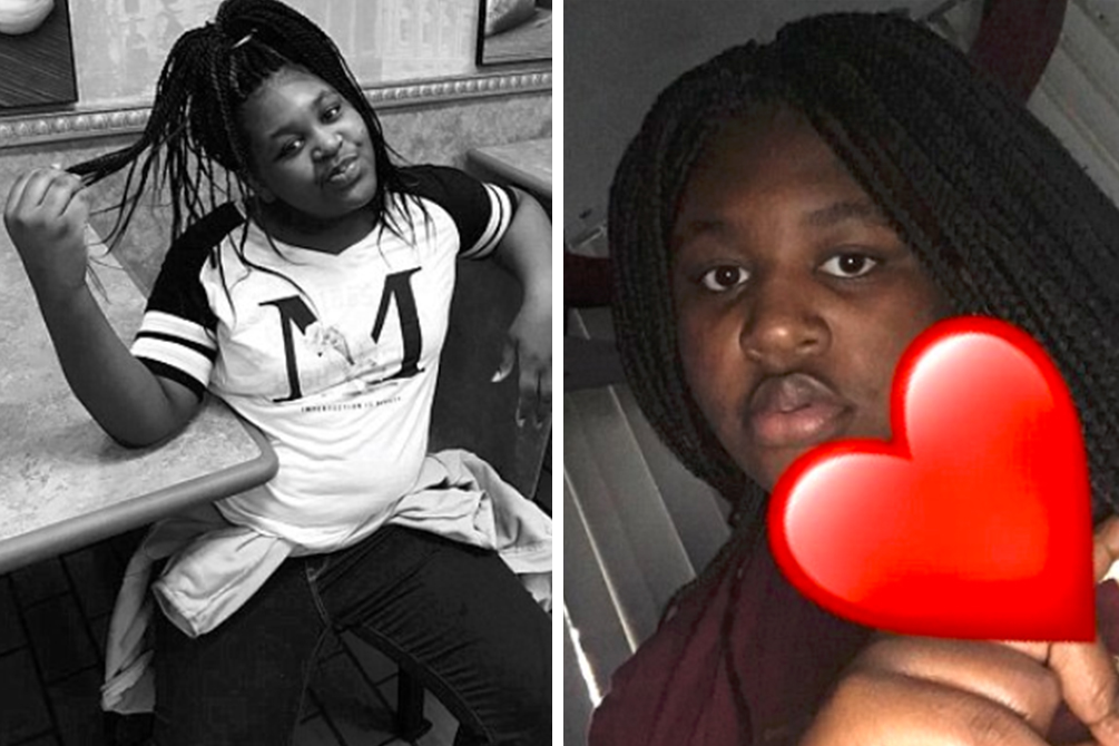 Menina de 12 anos tem 49% do corpo queimado após desafio do YouTube