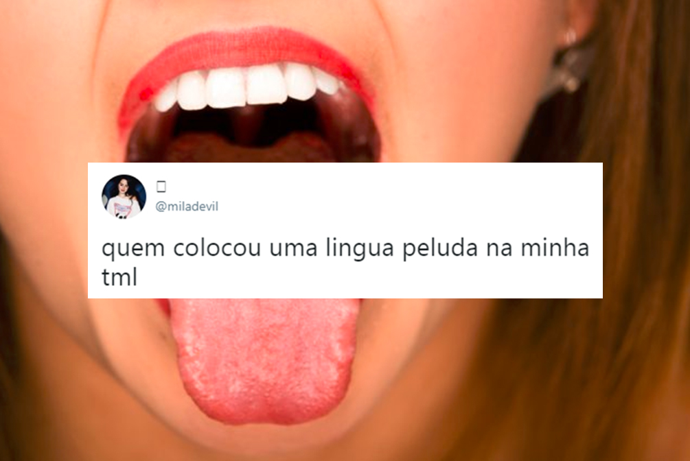 Mulher fica com “língua peluda” após tratamento e chama atenção