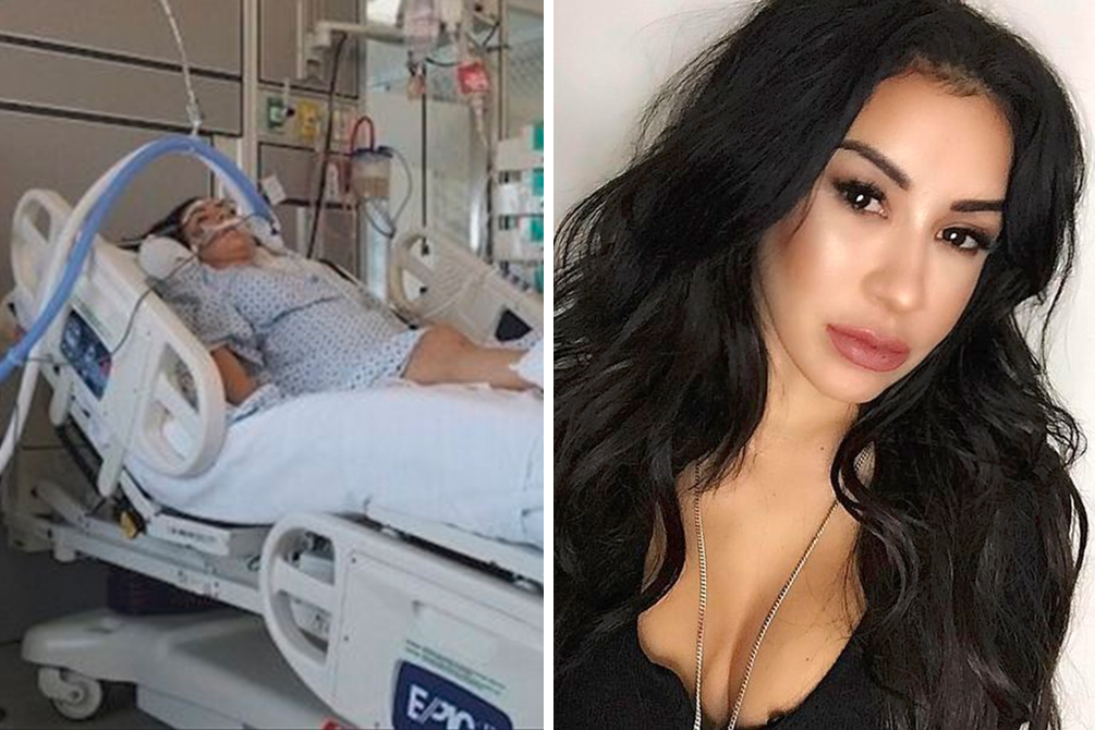 Mulher está em coma em UTI após popular procedimento estético