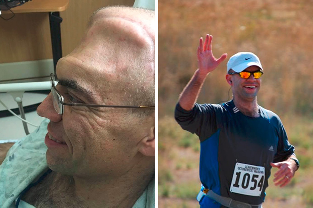 Com expectativa de vida de 6 anos, homem com câncer surpreende a todos