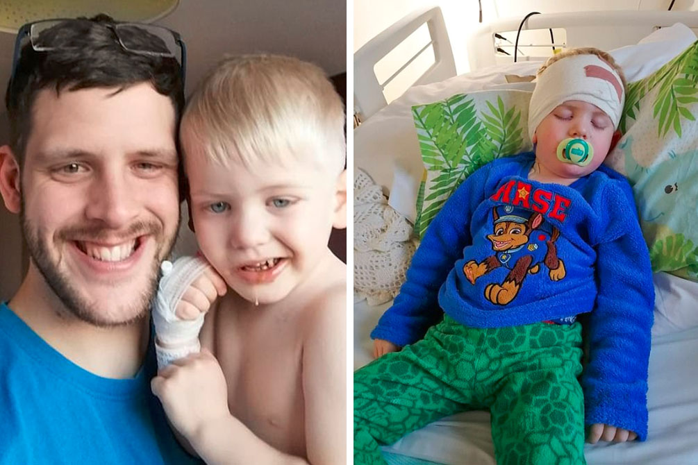 Menino de 3 anos é diagnosticado com câncer após exibir “novo sorriso”