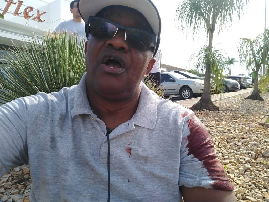 Professor da Unesp é chamado de “macaco” e esfaqueado em Bauru