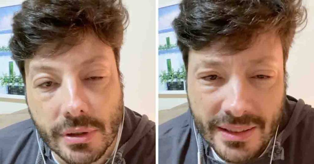 Danilo Gentili tem rosto deformado após choque anafilático