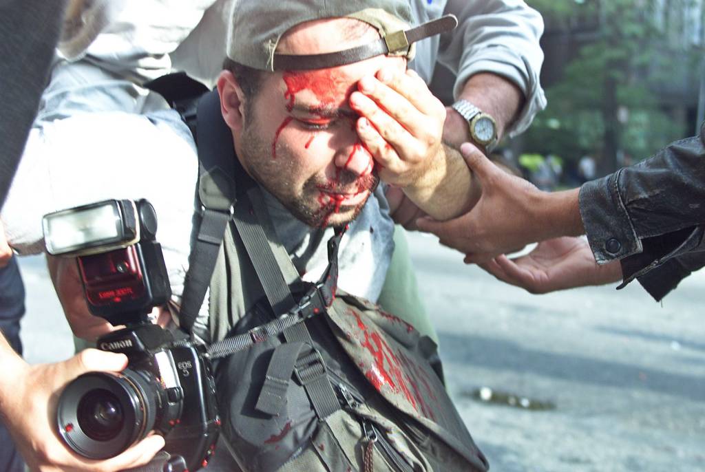 Fotógrafo atingido por bala de borracha será indenizado 21 anos depois