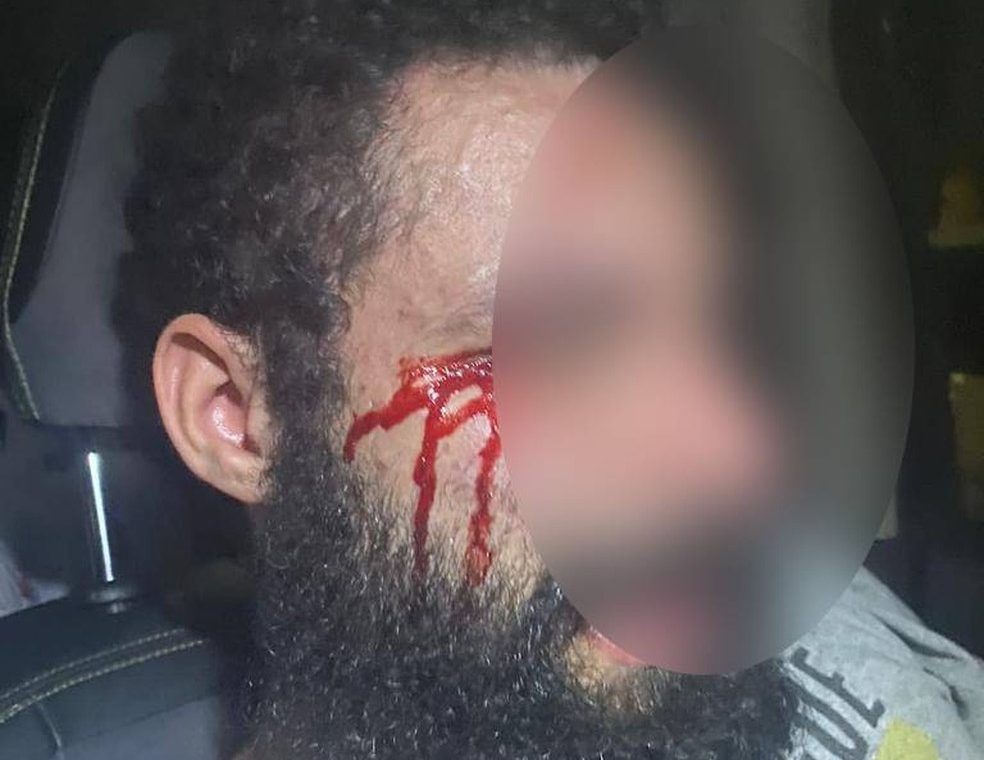 Médica que já mandou cortar pênis de ex é investigada por torturar marido