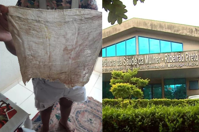 Após cesárea, mulher passa seis meses com pano dentro do ânus