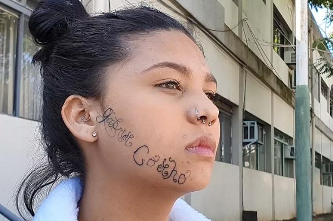 ‘Me matou por dentro’, diz jovem com rosto tatuado à força pelo ex