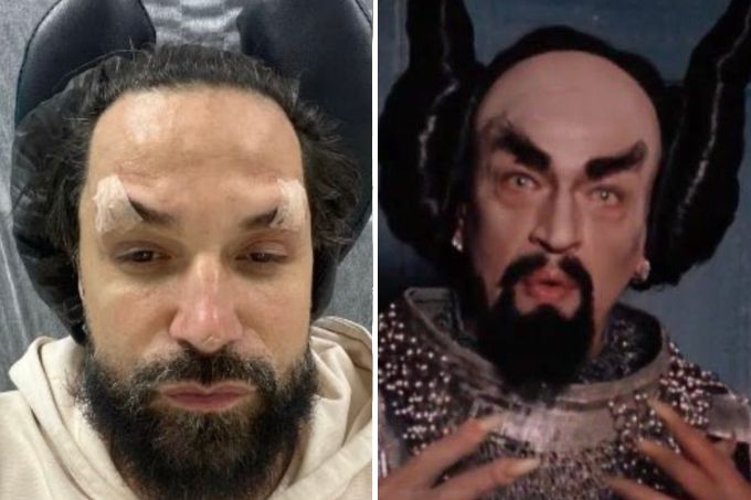 Latino é comparado a Diabo após fazer rejuvenescimento facial