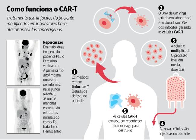Car-T Car-T