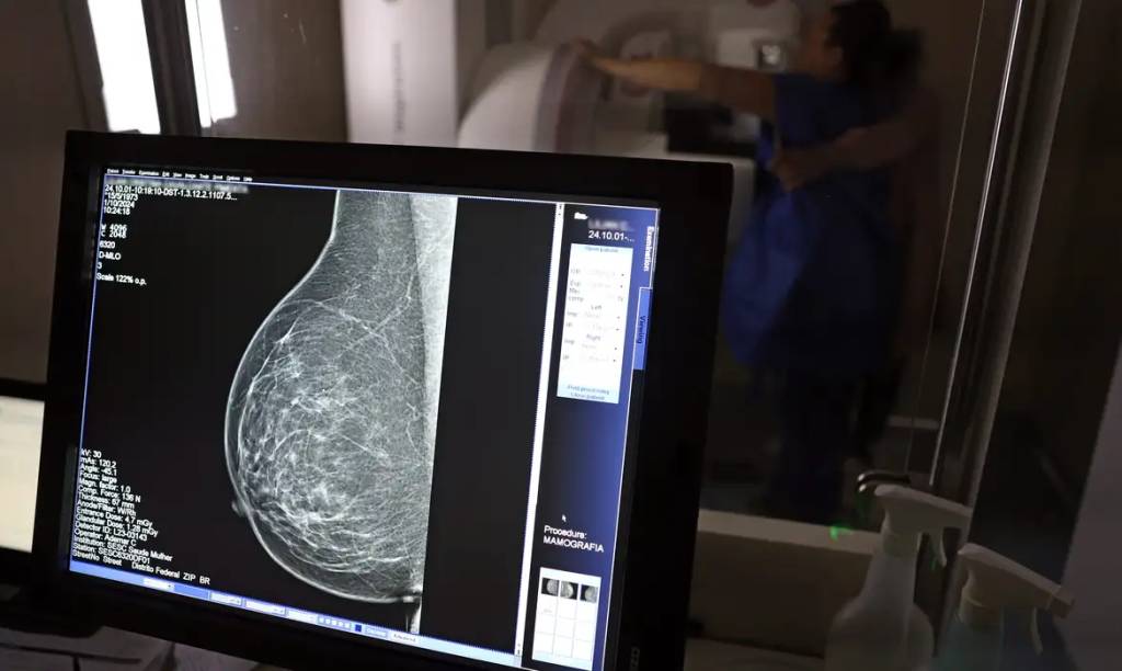 Outubro Rosa: ação oferece mamografias gratuitas no Shopping Eldorado entre 29 e 31 de outubro